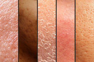 Image showing 5 Facial skin concerns ranging from oily skin acne, flaky, redness and large pores, Skin Devotee Facial Studio, Philadelphia