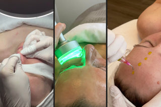 Professional extractions using BioSonic and BioRePeel during a personalized facial at Skin Devotee in Philadelphia to clear congestion and refine pores.