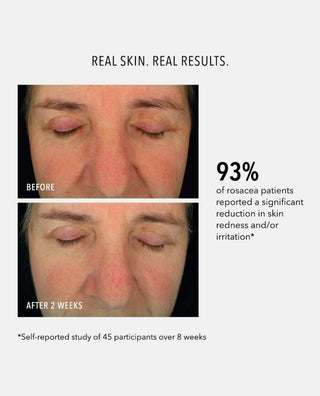 Hydropeptide Soothing Serum skin results