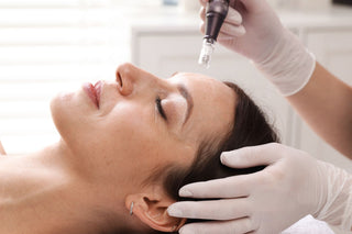 Woman receiving a microchanneling facial treatment with a device held by an esthetician
