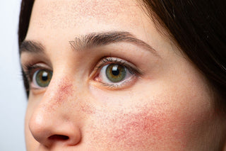 Sensitive skin facial treatment by esthetician at Skin Devotee Facial Studio in Philadelphia