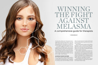 Winning the Fight Against Melasma by Skincare Expert Joanna Kula